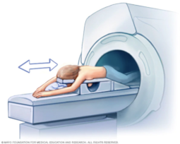 Mayo Clinic Breast MRI