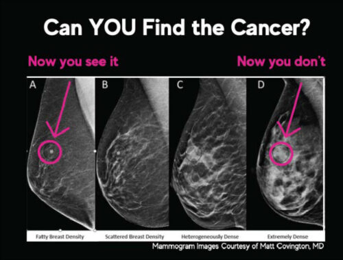 Can YOU find the cancer?