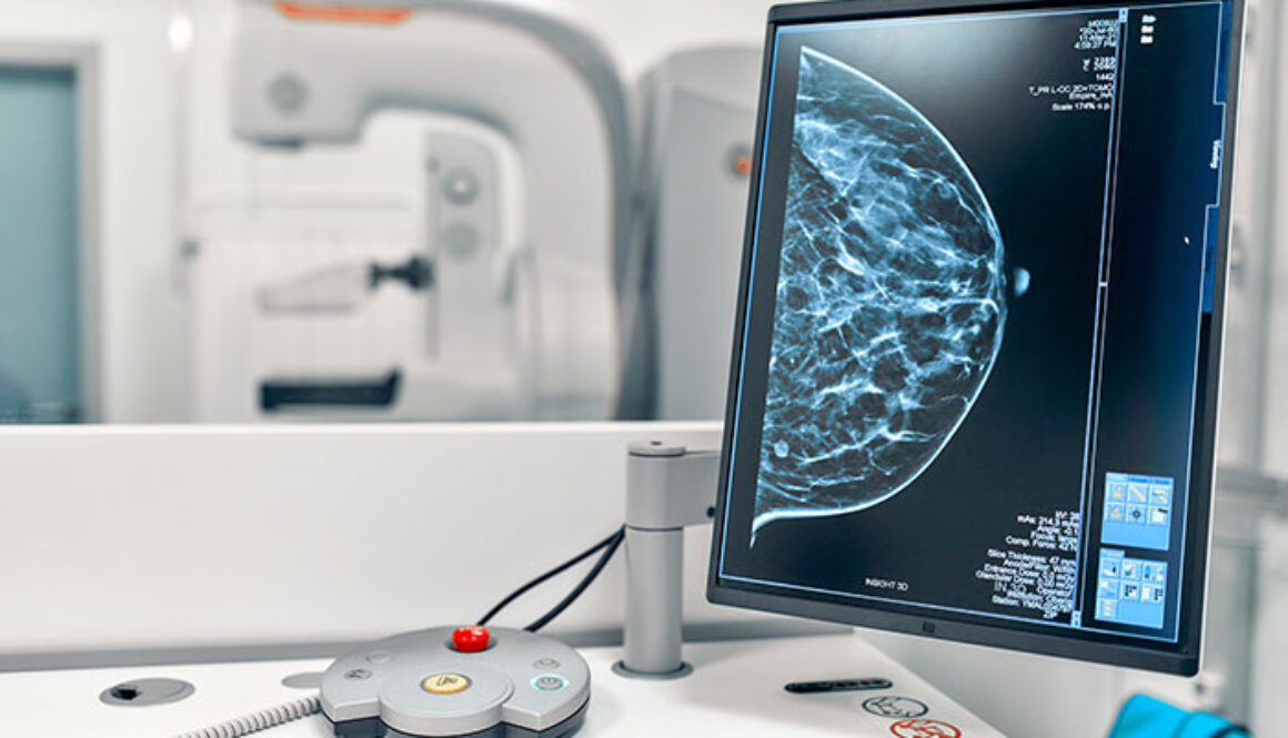 photo_mammography_gap