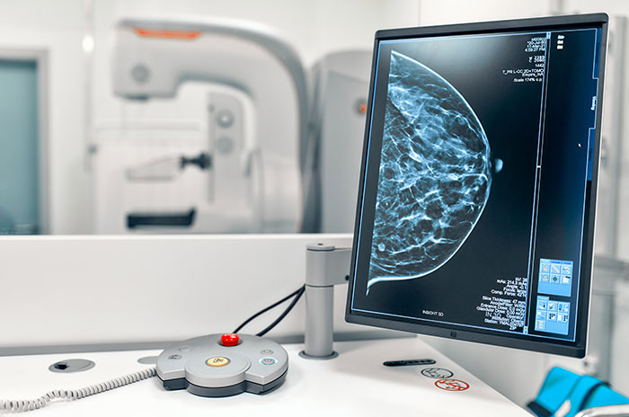 photo_mammography_gap